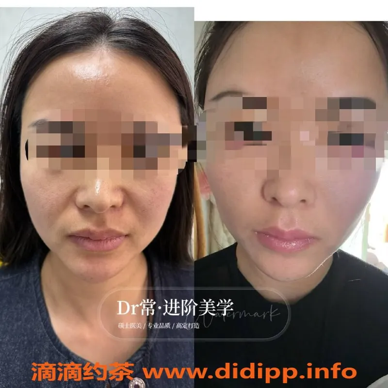 广州楼凤-广州瘦身与美容服务，专业注射提升体验