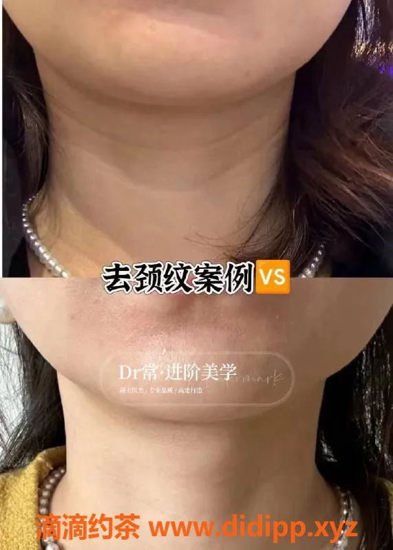 广州楼凤资源信息,广州瘦身与美容服务，专业注射提升体验