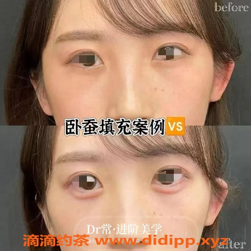 广州楼凤-广州瘦身与美容服务，专业注射提升体验