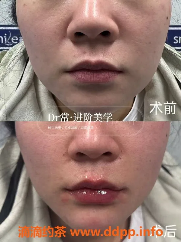 广州楼凤-广州瘦身与美容服务，专业注射提升体验